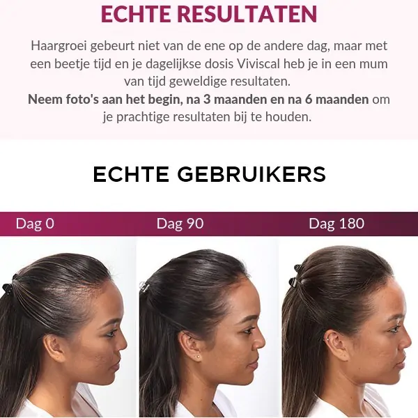 Productafbeelding 3